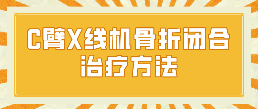 C臂X线机骨折闭合治疗方法